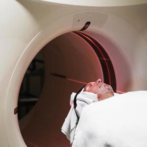 Was sind die neuen Alzheimer-Medikamente wirklich wert?